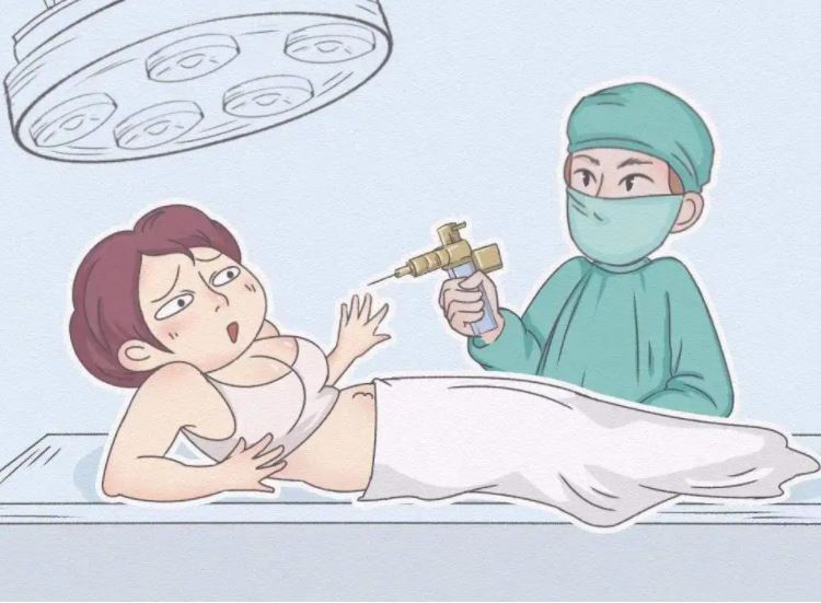全身抽脂對(duì)身體有什么傷害？